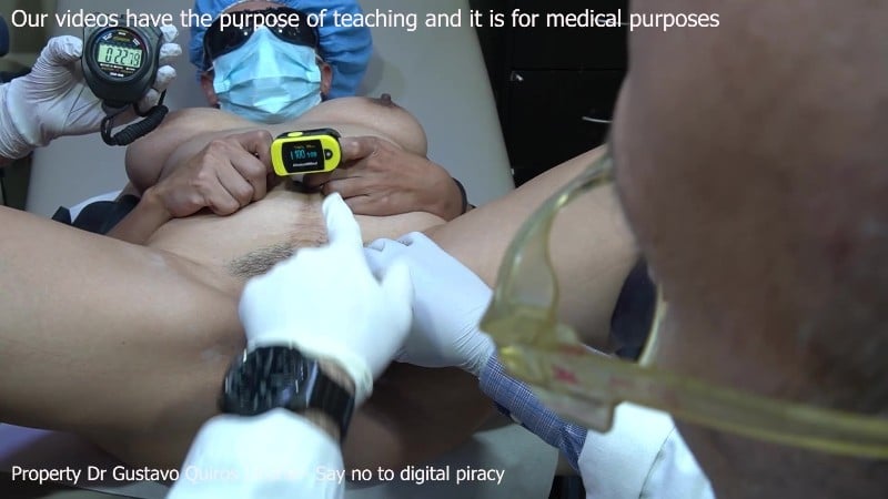 Medical 274 Sexual Response Slow Continuous Stimulation Fast Didactic Intermitte 8