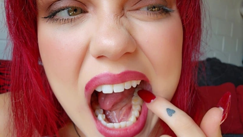 Ginger Rae xoxo - Teeth and Cavity Inspection - Tooth Fetish - Ginger Rae 2