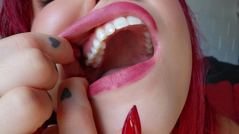 Ginger Rae xoxo - Teeth and Cavity Inspection - Tooth Fetish - Ginger Rae 1
